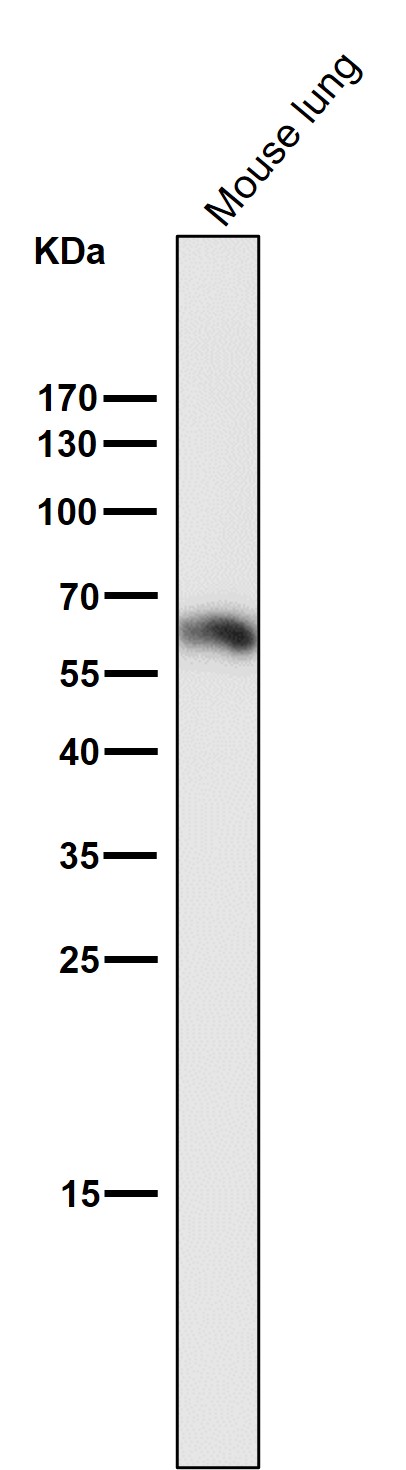 WB - Anti-Phospho-Smad3 (S423 + S425) Rabbit Monoclonal Antibody ABO13199